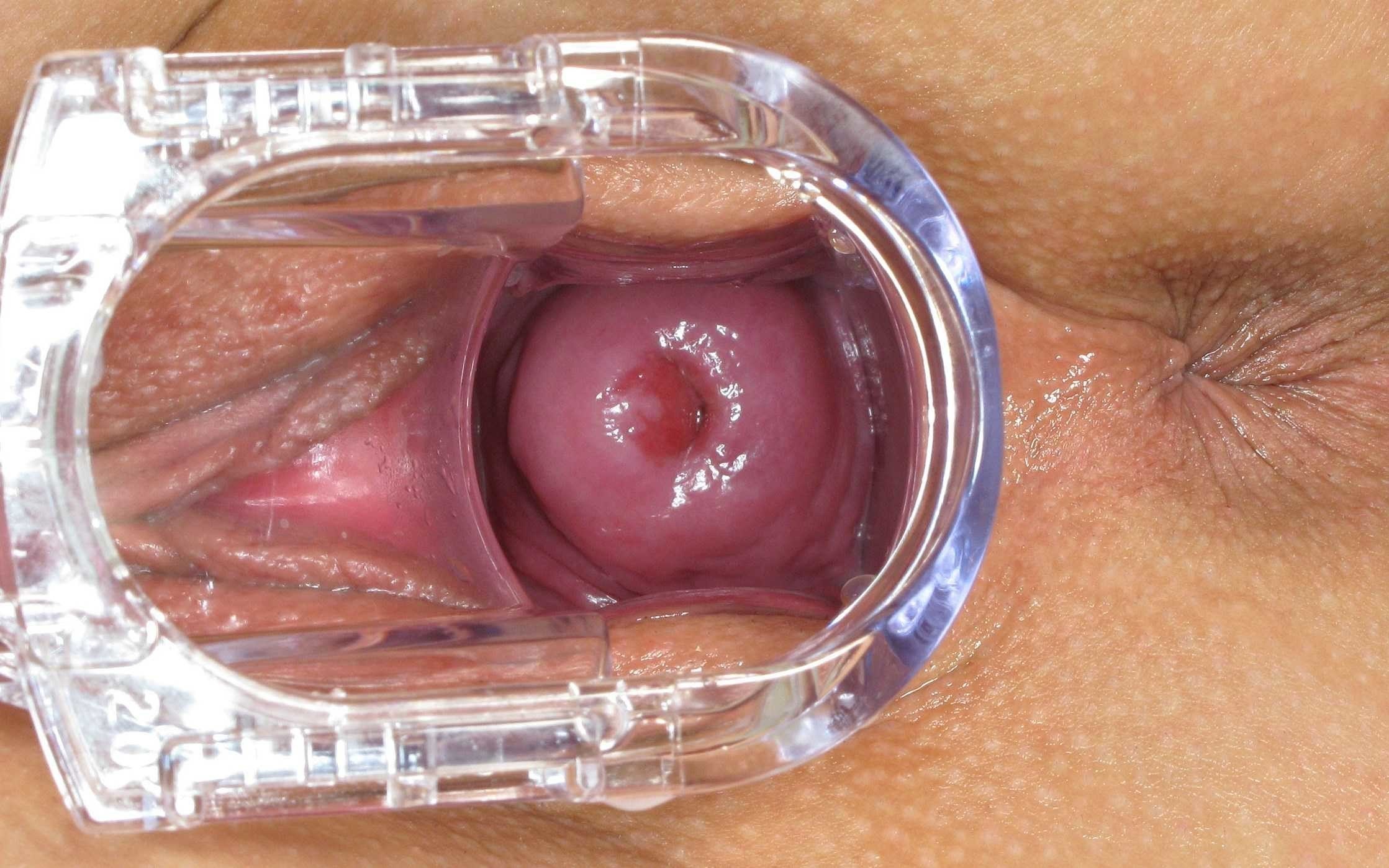 порно внутри вагины (120) фото