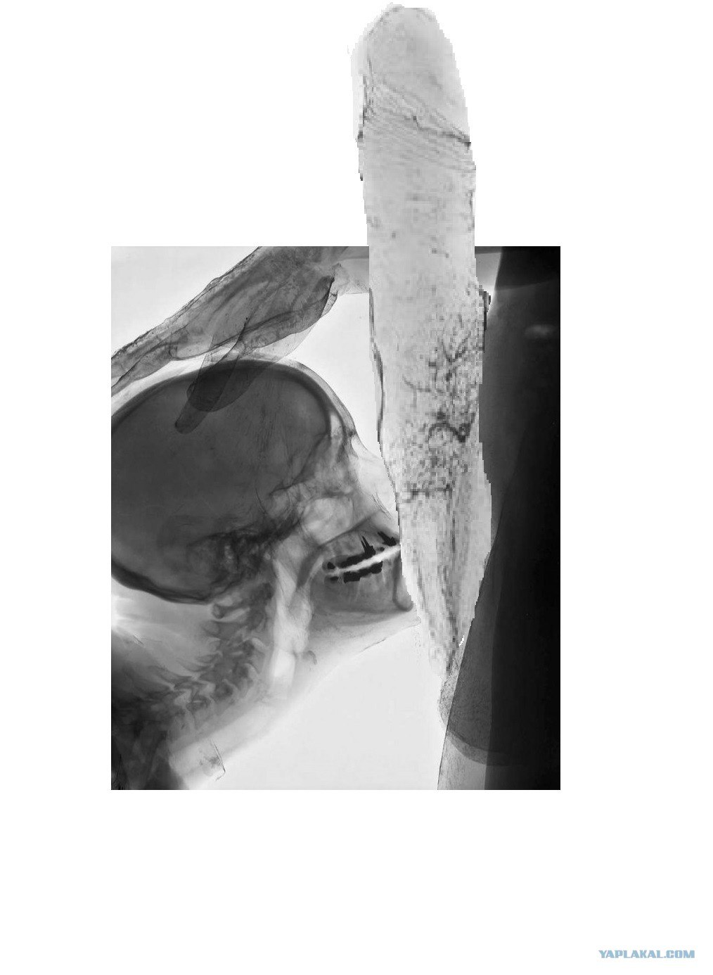 рентген с членом во рту фото 12