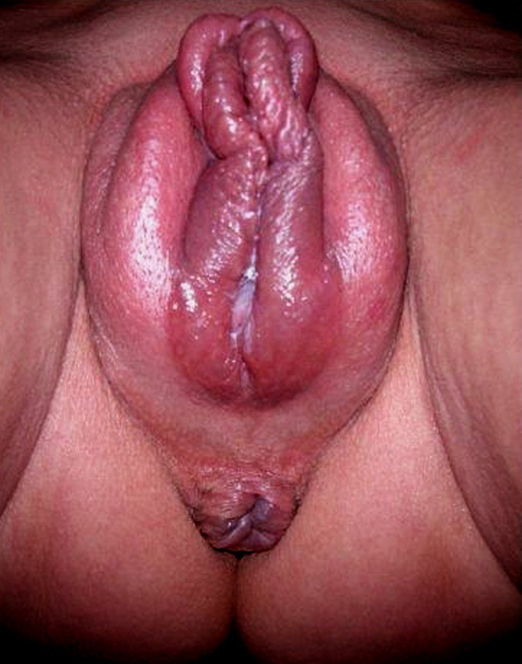 Дамы с накаченной помпой вагины (80 фото) - порно